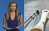 Inna Puhajková má nohu v gypsu