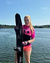 Marešova exmanželka Monika ukázala následky děsivého úrazu